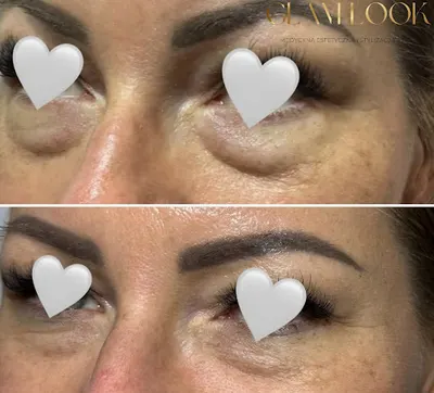 Glam look - Medycyna Estetyczna Słupsk